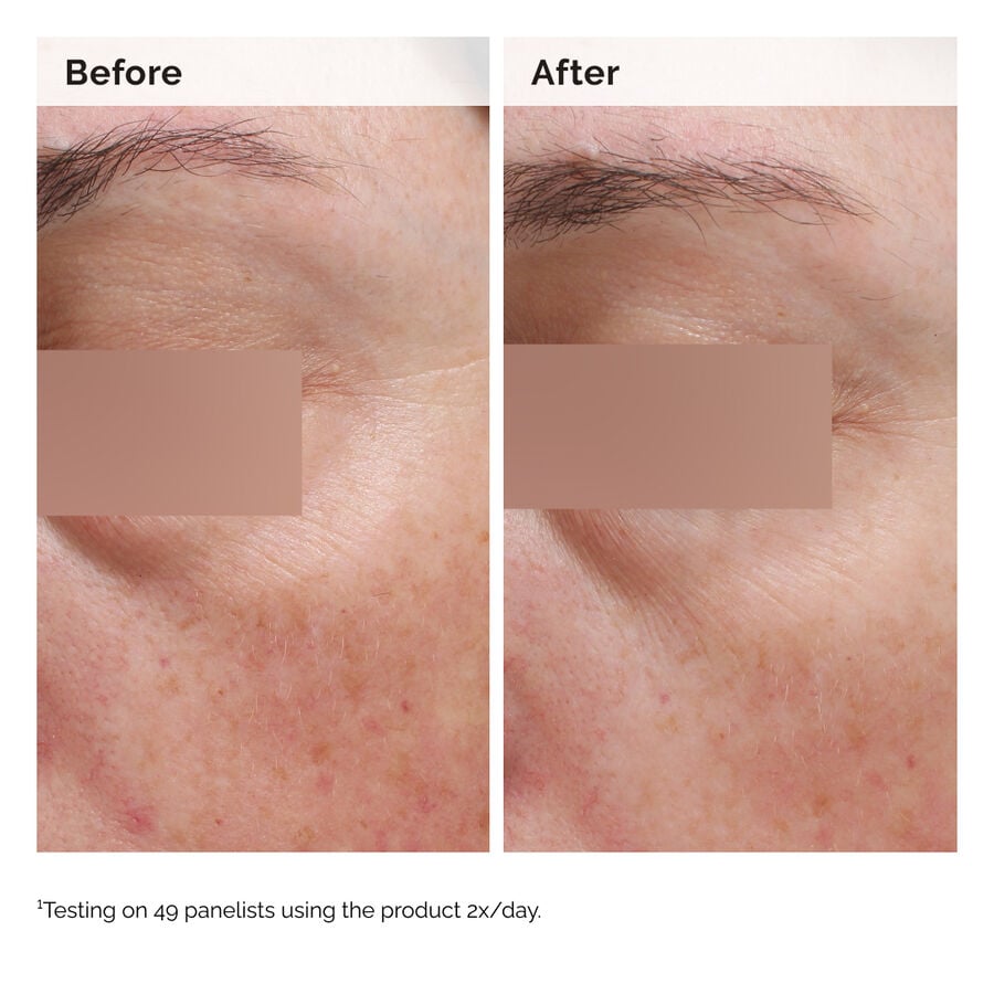 niacinamide-5-face-and-body-emulsion-e2 2024-08-23-ORD-Nia-5pct-Face-Body-B-A-Elasticity-Global-02-1x1.jpg