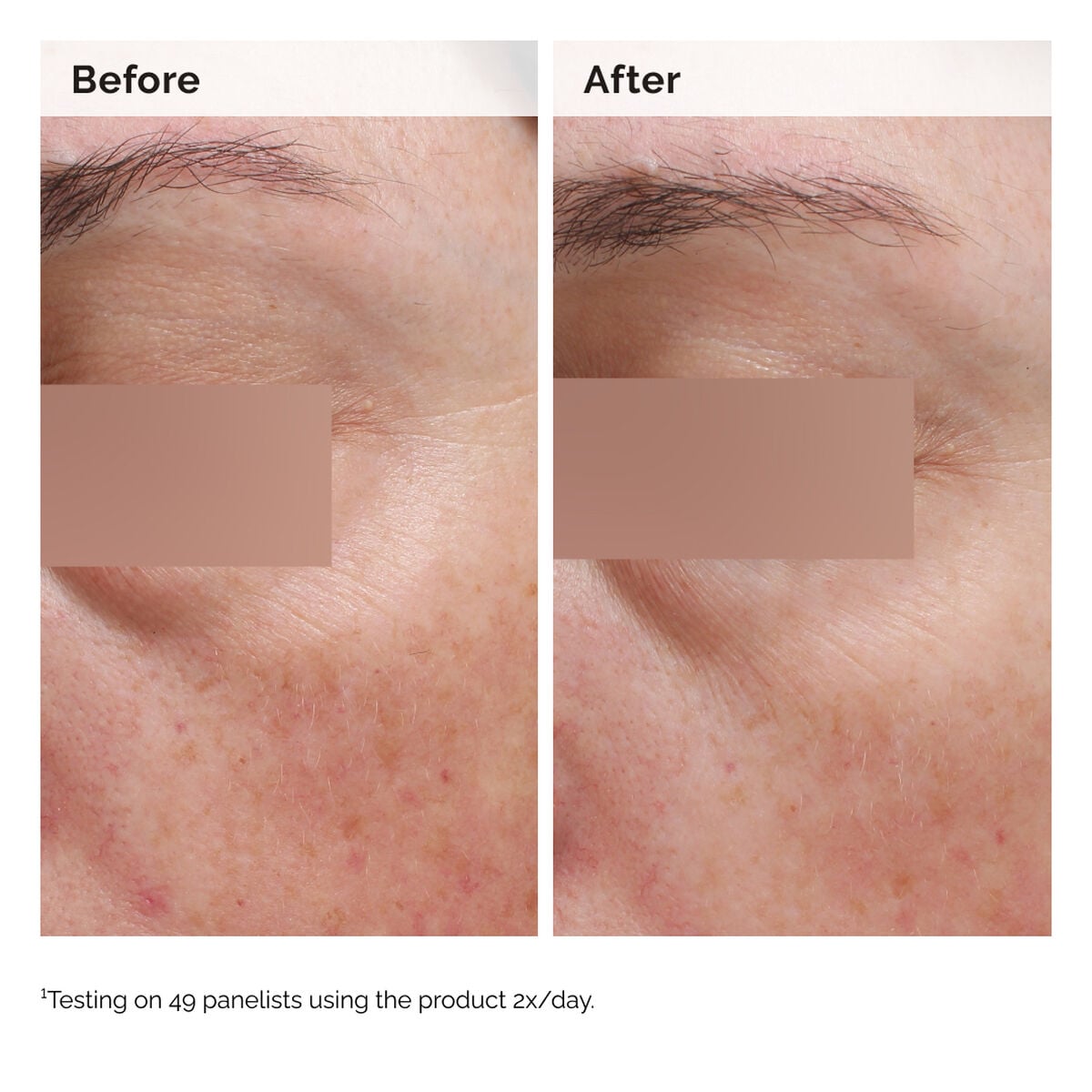 niacinamide-5-face-and-body-emulsion-e2 2024-08-23-ORD-Nia-5pct-Face-Body-B-A-Elasticity-Global-02-1x1.jpg