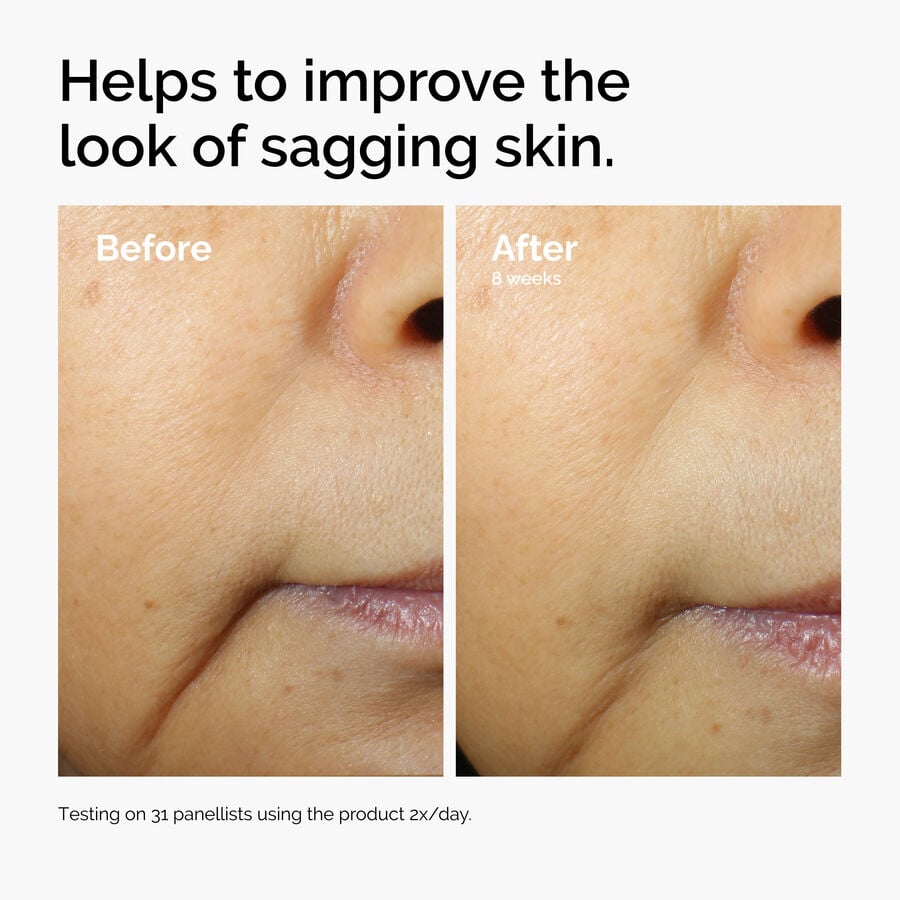 caffeine-3-escin-1-face-serum-j4 ord-caffeine-3pct-escin-1pct-face-serum-before-after-sagging.jpg