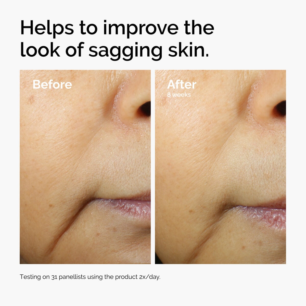 caffeine-3-escin-1-face-serum-j4 ord-caffeine-3pct-escin-1pct-face-serum-before-after-sagging.jpg