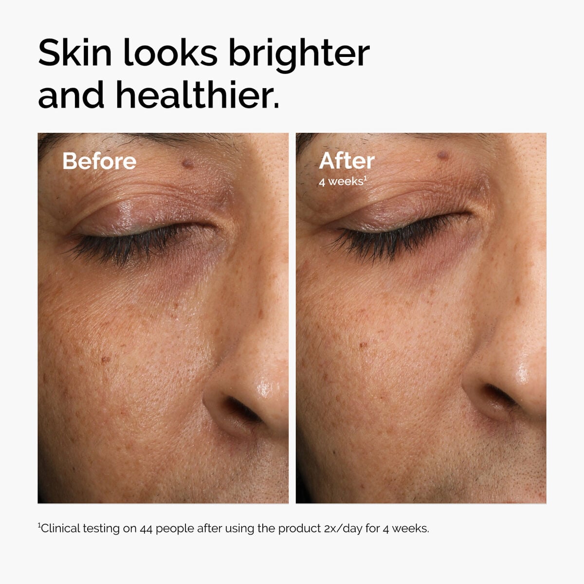 multi-antioxidant-radiance-serum-h4 ord-mars-before-after-healthy.jpg