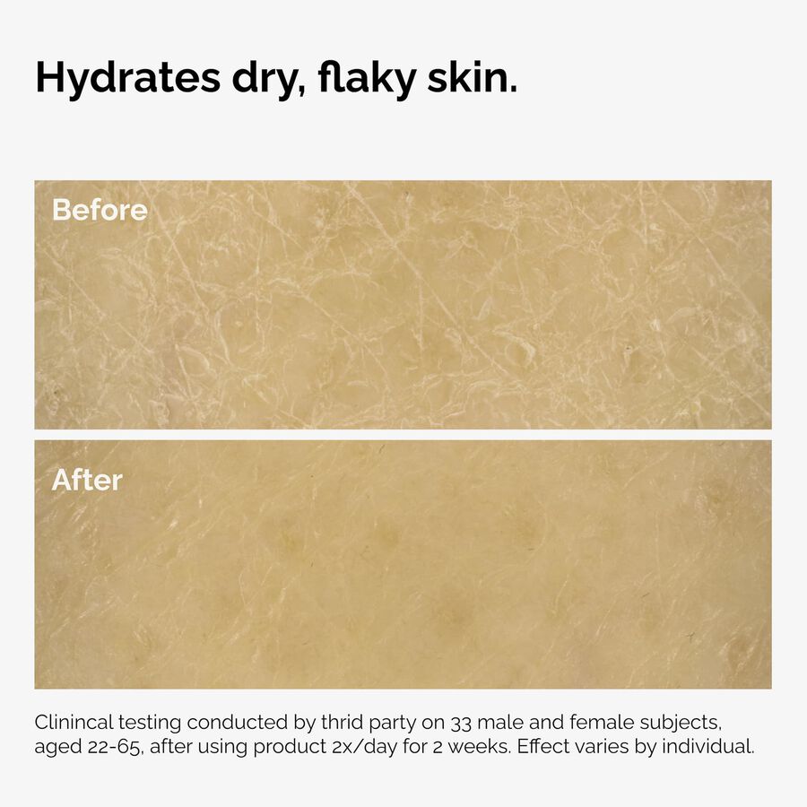 the-body-care-collection-w3 ord-natural-moisturizing-factors-inulin-body-before-after-graphic-02.jpg