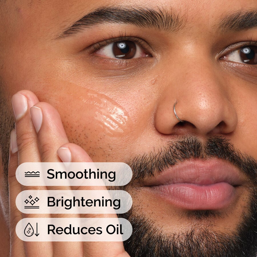niacinamide-10-zinc-1-w9 ord-niacinamide-10-zic-1-model-application-with-benefits.jpg