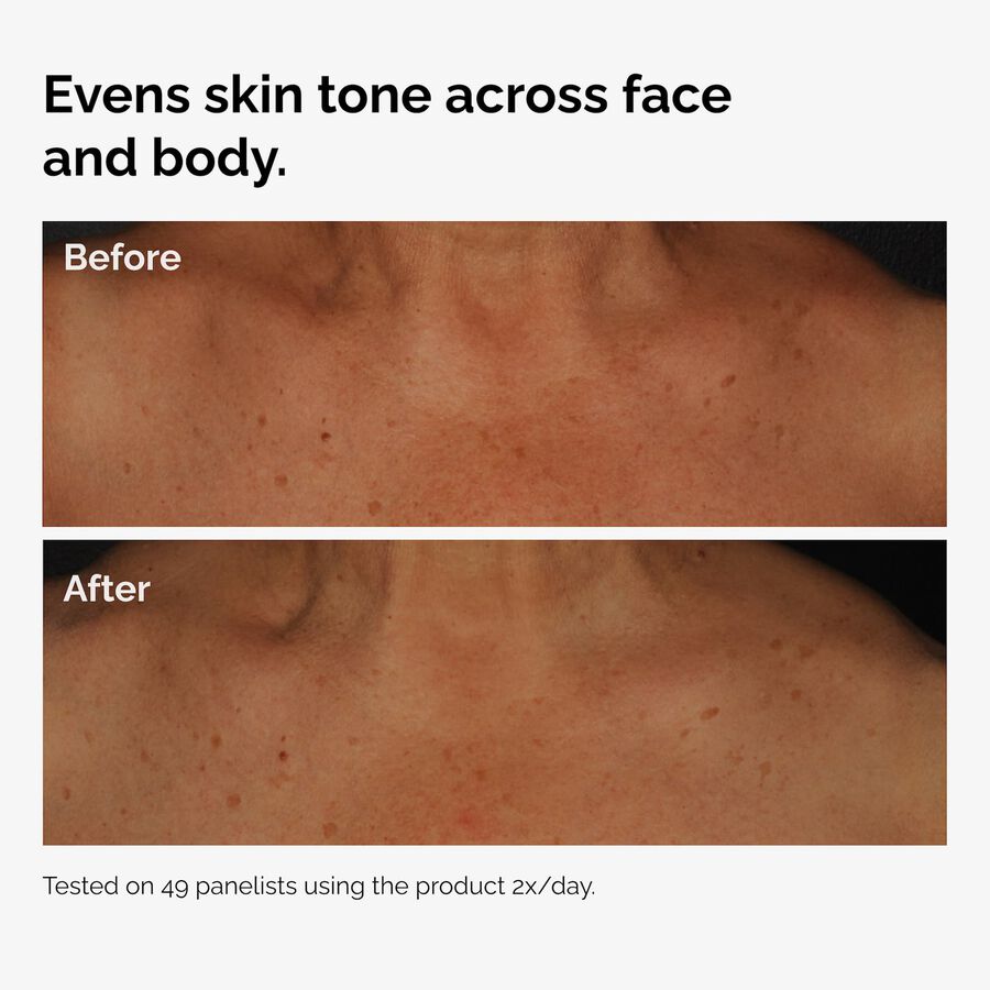 the-body-care-collection-w3 ord-niacinamide-face-body-serum-before-after-even-tone-graphic.jpg