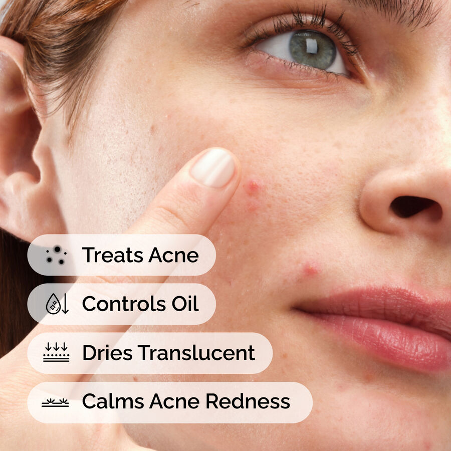 sulfur-10-powder-to-cream-concentrate-u1 ord-sulfur-10pct-powder-to-cream-concentrate-model-application-with-benefits-acne.jpg